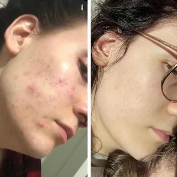 Before & After